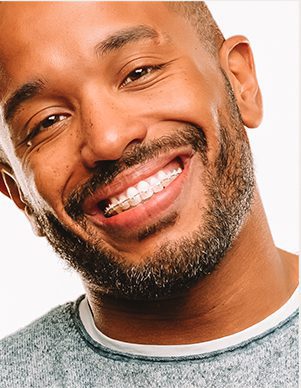 Man smiling and wearing clear metal braces